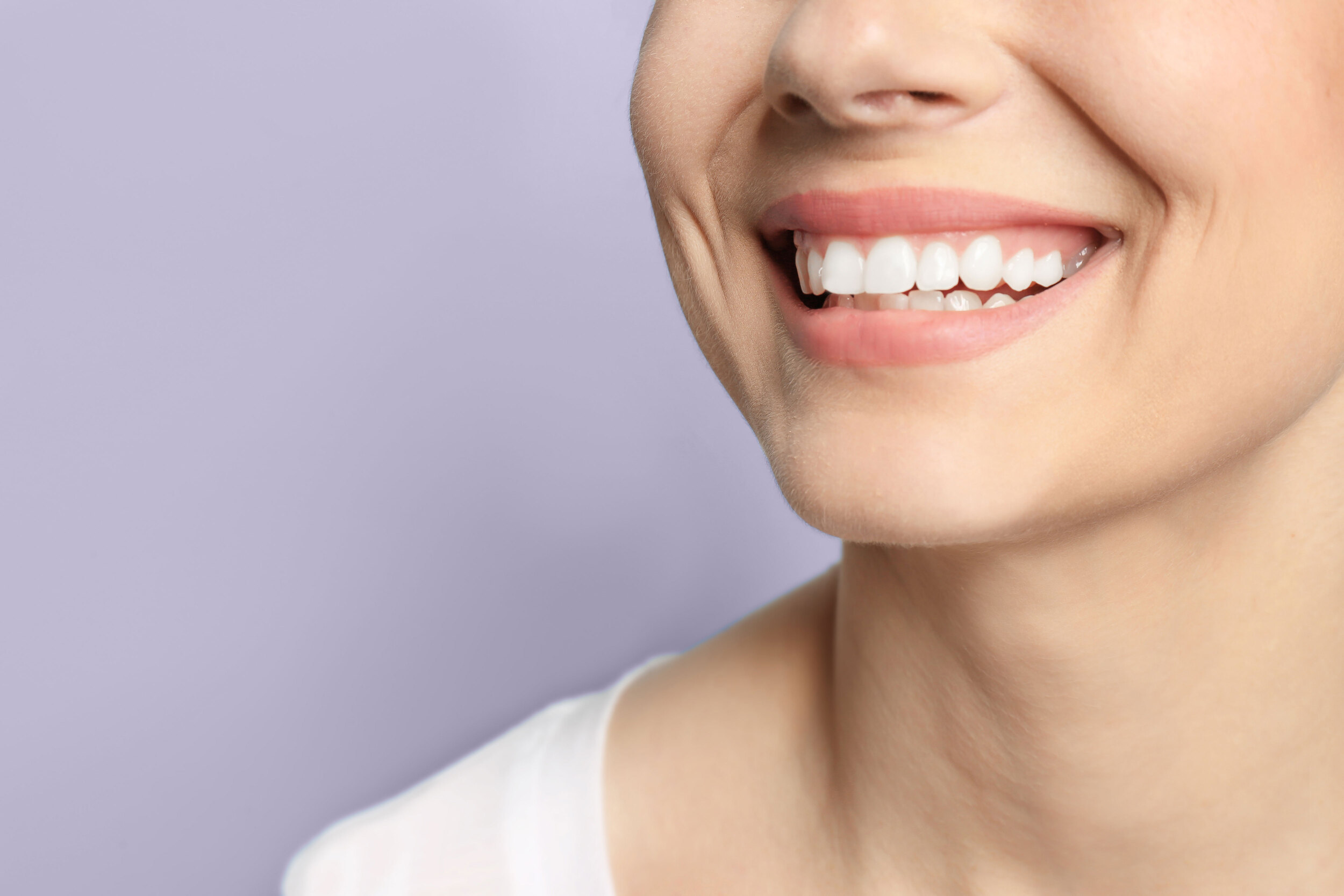 Aesthetic smile line