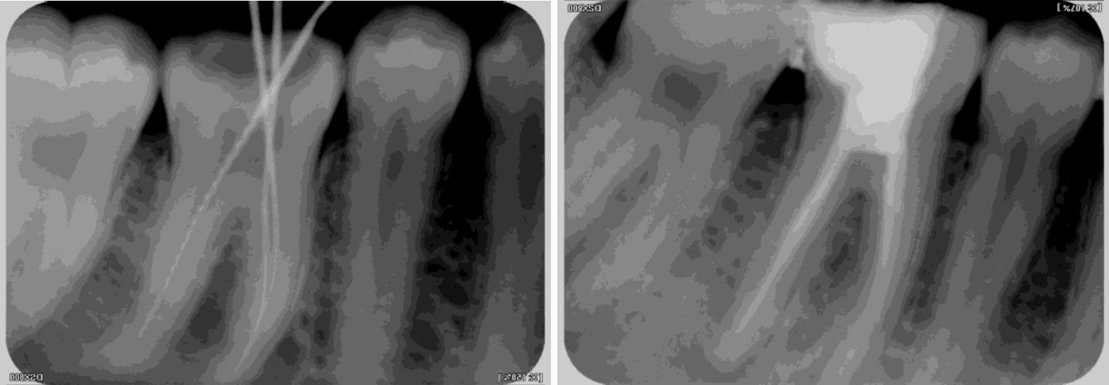 RCT X-Rays Case