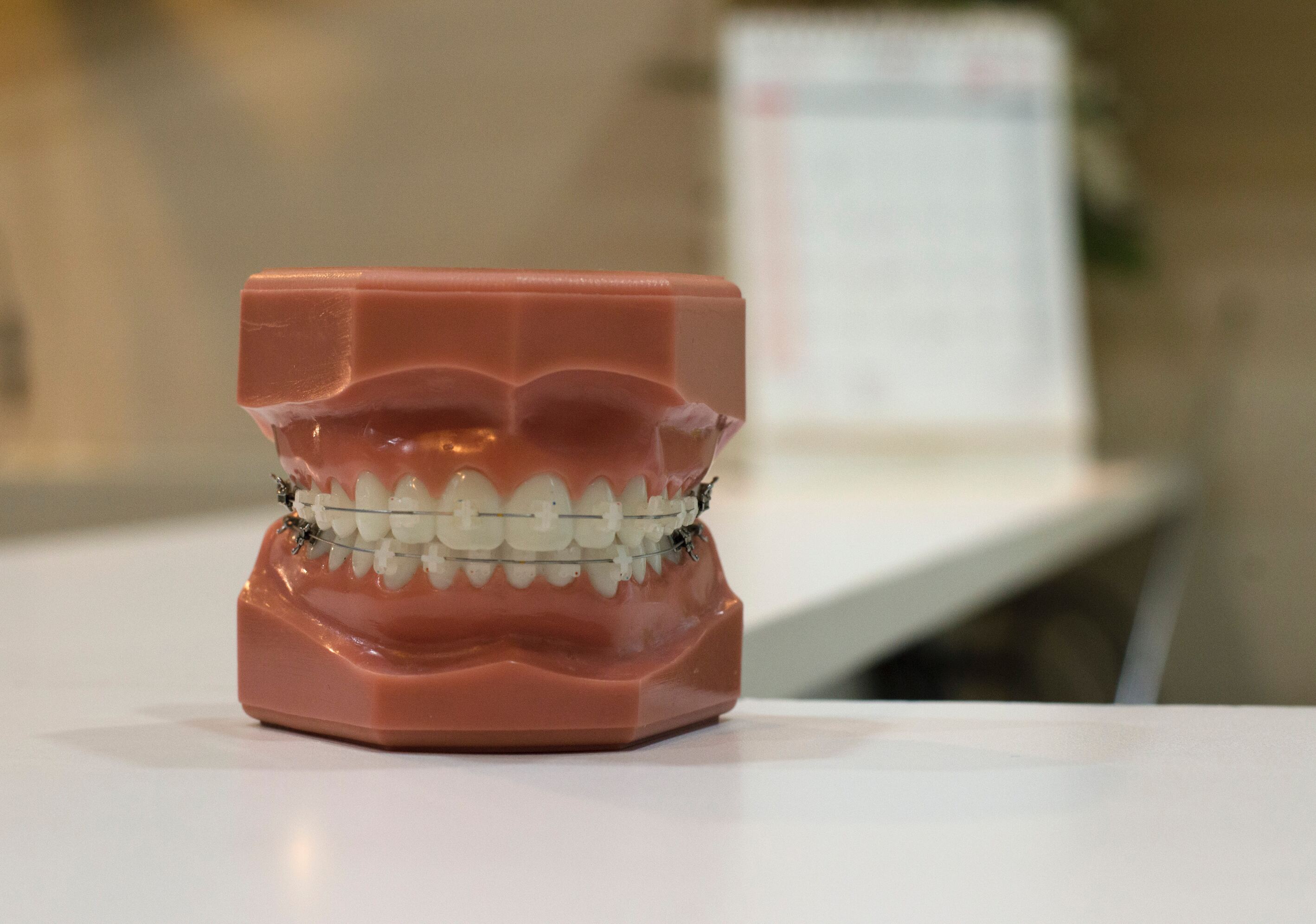 Orthodontic braces setup