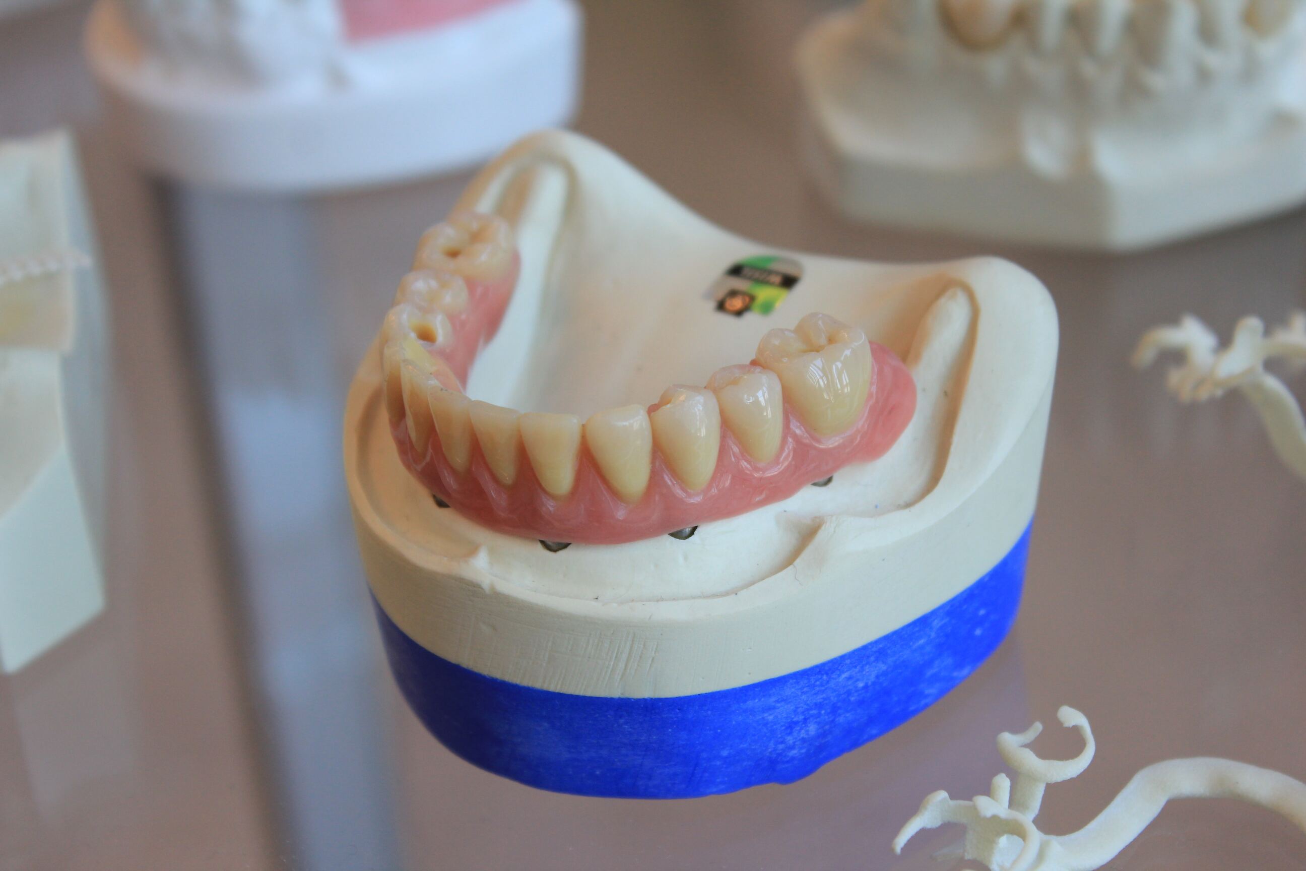 Prosthodontic lab work
